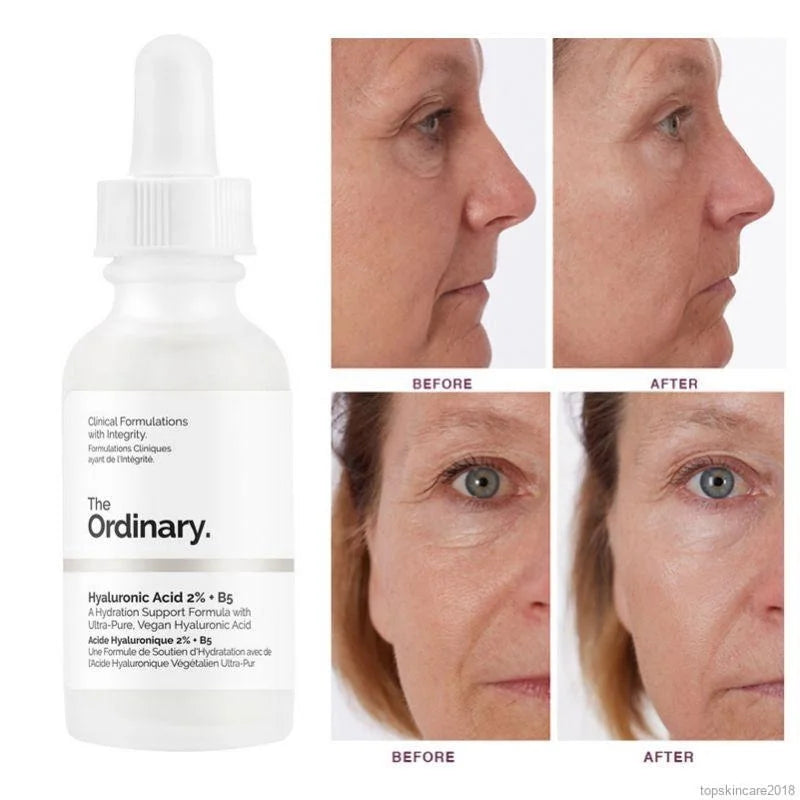 The Ordinary Hyaluronic Acid  + B5 Serum-30 ml