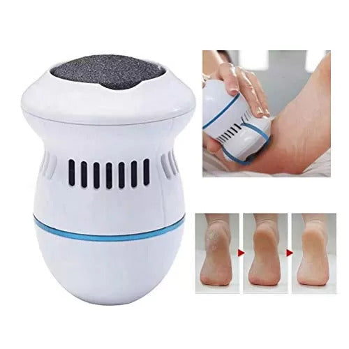 Electric Foot Grinder & Callus Remover - Rechargeable Pedicure Tool