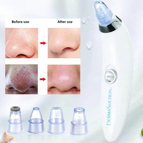 Derma Suction Blackhead, Whitehead, Dirt, & Oil Remover